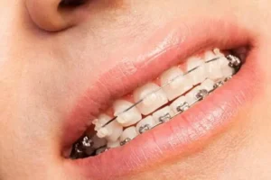 Top 10 Dental Practices in the South Plains for 2026 Exceptional Care and Cutting-Edge Innovation