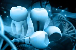 The Science Behind Dental Implants and Long-Lasting Smile Restoration