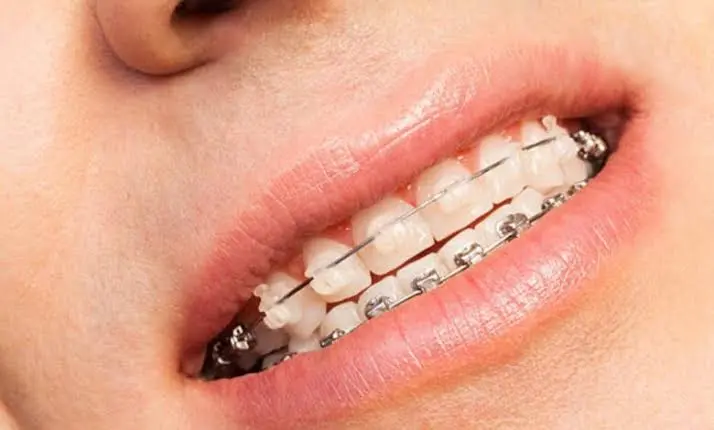 Top 10 Dental Practices in the South Plains for 2026 Exceptional Care and Cutting-Edge Innovation